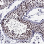 TAF9 Polyclonal Antibody