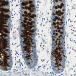 MUC4 Antibody in Immunohistochemistry (Paraffin) (IHC (P))