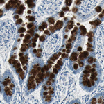 MUC4 Antibody in Immunohistochemistry (Paraffin) (IHC (P))