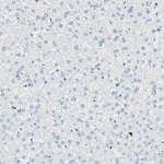 CYSLTR1 Antibody in Immunohistochemistry (Paraffin) (IHC (P))