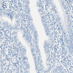 CYSLTR1 Antibody in Immunohistochemistry (Paraffin) (IHC (P))