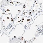 CYSLTR1 Antibody in Immunohistochemistry (Paraffin) (IHC (P))