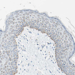 CYSLTR1 Polyclonal Antibody