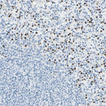 CYSLTR1 Antibody in Immunohistochemistry (Paraffin) (IHC (P))