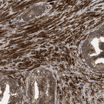 FZD6 Polyclonal Antibody