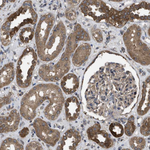 FZD6 Antibody in Immunohistochemistry (Paraffin) (IHC (P))
