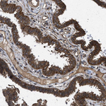 FZD6 Antibody in Immunohistochemistry (Paraffin) (IHC (P))