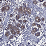 GPD1 Polyclonal Antibody