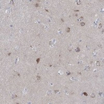 WASF3 Antibody in Immunohistochemistry (Paraffin) (IHC (P))