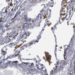CYBA Antibody in Immunohistochemistry (Paraffin) (IHC (P))