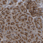 GADD34 Polyclonal Antibody