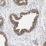 GADD34 Antibody in Immunohistochemistry (Paraffin) (IHC (P))