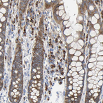 GADD34 Antibody in Immunohistochemistry (Paraffin) (IHC (P))
