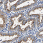 GADD34 Antibody in Immunohistochemistry (Paraffin) (IHC (P))