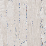 RAD54B Antibody in Immunohistochemistry (Paraffin) (IHC (P))