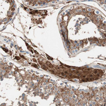 RAD54B Antibody in Immunohistochemistry (Paraffin) (IHC (P))