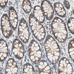RAD54B Antibody in Immunohistochemistry (Paraffin) (IHC (P))