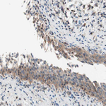 RAD54B Antibody in Immunohistochemistry (Paraffin) (IHC (P))