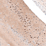 NOR-1 Antibody in Immunohistochemistry (Paraffin) (IHC (P))