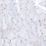 NOR-1 Antibody in Immunohistochemistry (Paraffin) (IHC (P))