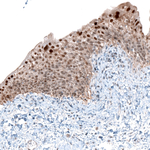 NOR-1 Antibody in Immunohistochemistry (Paraffin) (IHC (P))