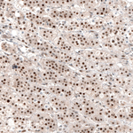 NOR-1 Polyclonal Antibody