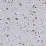 MMP24 Antibody in Immunohistochemistry (Paraffin) (IHC (P))