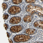 Urokinase Antibody in Immunohistochemistry (Paraffin) (IHC (P))