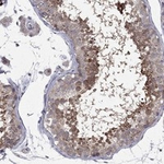 DUSP7 Antibody in Immunohistochemistry (Paraffin) (IHC (P))