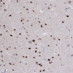 HES5 Antibody in Immunohistochemistry (Paraffin) (IHC (P))