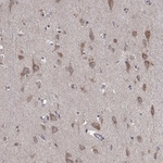 Iduronate 2 Sulfatase Polyclonal Antibody