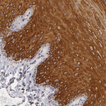 ALAS2 Polyclonal Antibody