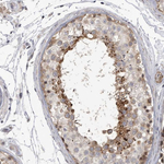 SSX2IP Polyclonal Antibody