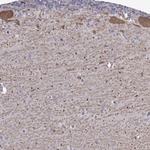 FEZ1 Polyclonal Antibody