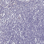 SSTR1 Antibody in Immunohistochemistry (Paraffin) (IHC (P))