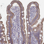 SSTR1 Antibody in Immunohistochemistry (Paraffin) (IHC (P))