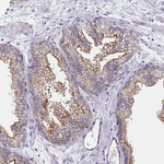 SSTR1 Antibody in Immunohistochemistry (Paraffin) (IHC (P))
