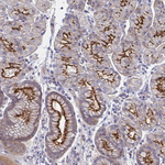 SSTR1 Antibody in Immunohistochemistry (Paraffin) (IHC (P))