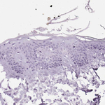SP7 Antibody in Immunohistochemistry (Paraffin) (IHC (P))