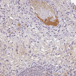 C1QB Antibody in Immunohistochemistry (Paraffin) (IHC (P))