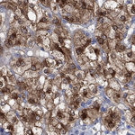 CPLX2 Antibody in Immunohistochemistry (Paraffin) (IHC (P))