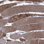 HSPB2 Antibody in Immunohistochemistry (Paraffin) (IHC (P))