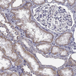 HSPB2 Antibody in Immunohistochemistry (Paraffin) (IHC (P))