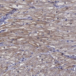 HSPB2 Polyclonal Antibody