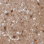 NRXN3 Antibody in Immunohistochemistry (Paraffin) (IHC (P))