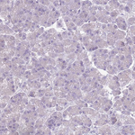 DcR3 Antibody in Immunohistochemistry (Paraffin) (IHC (P))