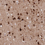 DcR3 Antibody in Immunohistochemistry (Paraffin) (IHC (P))