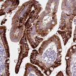 DcR3 Antibody in Immunohistochemistry (Paraffin) (IHC (P))