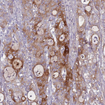 DcR3 Polyclonal Antibody
