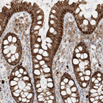 AIM2 Antibody in Immunohistochemistry (Paraffin) (IHC (P))
